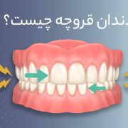 دکترمحمدسعیدساغری ایمپلنتولوژيست دندانپزشک جراح دندانپزشک drsagharidds mohammadsaiedsaghari drsagharid dentist