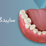 دکترمحمدسعیدساغری ایمپلنتولوژيست دندانپزشک جراح دندانپزشک drsagharidds mohammadsaiedsaghari drsagharid dentist