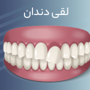 دکترمحمدسعیدساغری ایمپلنتولوژيست دندانپزشک جراح دندانپزشک drsagharidds mohammadsaiedsaghari drsagharid dentist