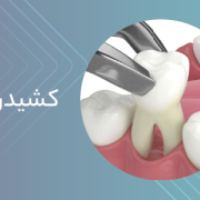 دکترمحمدسعیدساغری ایمپلنتولوژيست دندانپزشک جراح دندانپزشک drsagharidds mohammadsaiedsaghari drsagharid dentist