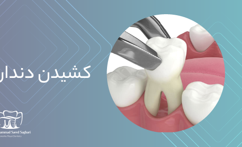 دکترمحمدسعیدساغری ایمپلنتولوژيست دندانپزشک جراح دندانپزشک drsagharidds mohammadsaiedsaghari drsagharid dentist