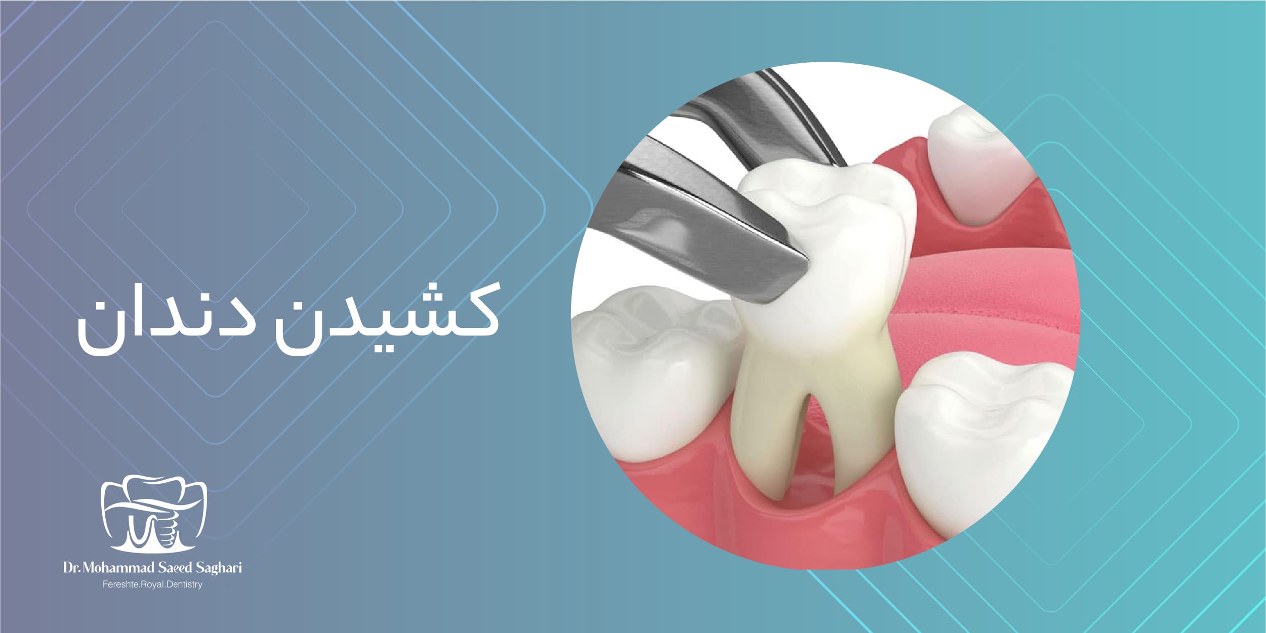 دکترمحمدسعیدساغری ایمپلنتولوژيست دندانپزشک جراح دندانپزشک drsagharidds mohammadsaiedsaghari drsagharid dentist