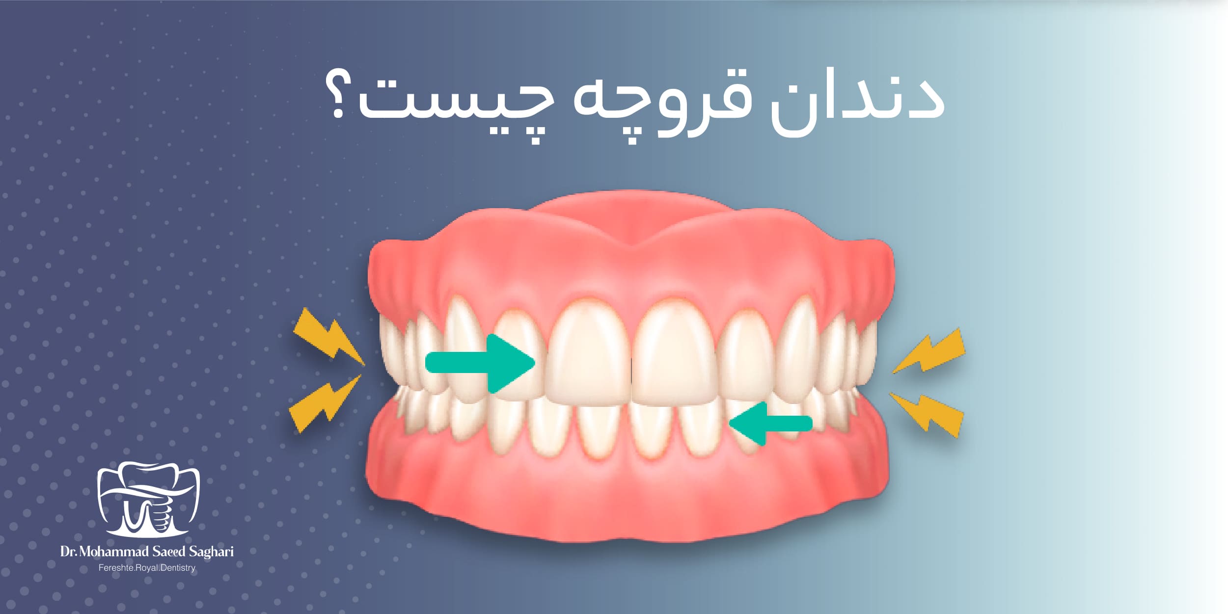 دکترمحمدسعیدساغری ایمپلنتولوژيست دندانپزشک جراح دندانپزشک drsagharidds mohammadsaiedsaghari drsagharid dentist