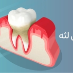 دکترمحمدسعیدساغری ایمپلنتولوژيست دندانپزشک جراح دندانپزشک drsagharidds mohammadsaiedsaghari drsagharid dentistدکترمحمدسعیدساغری ایمپلنتولوژيست دندانپزشک جراح دندانپزشک drsagharidds mohammadsaiedsaghari drsagharid dentist