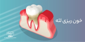 دکترمحمدسعیدساغری ایمپلنتولوژيست دندانپزشک جراح دندانپزشک drsagharidds mohammadsaiedsaghari drsagharid dentistدکترمحمدسعیدساغری ایمپلنتولوژيست دندانپزشک جراح دندانپزشک drsagharidds mohammadsaiedsaghari drsagharid dentist