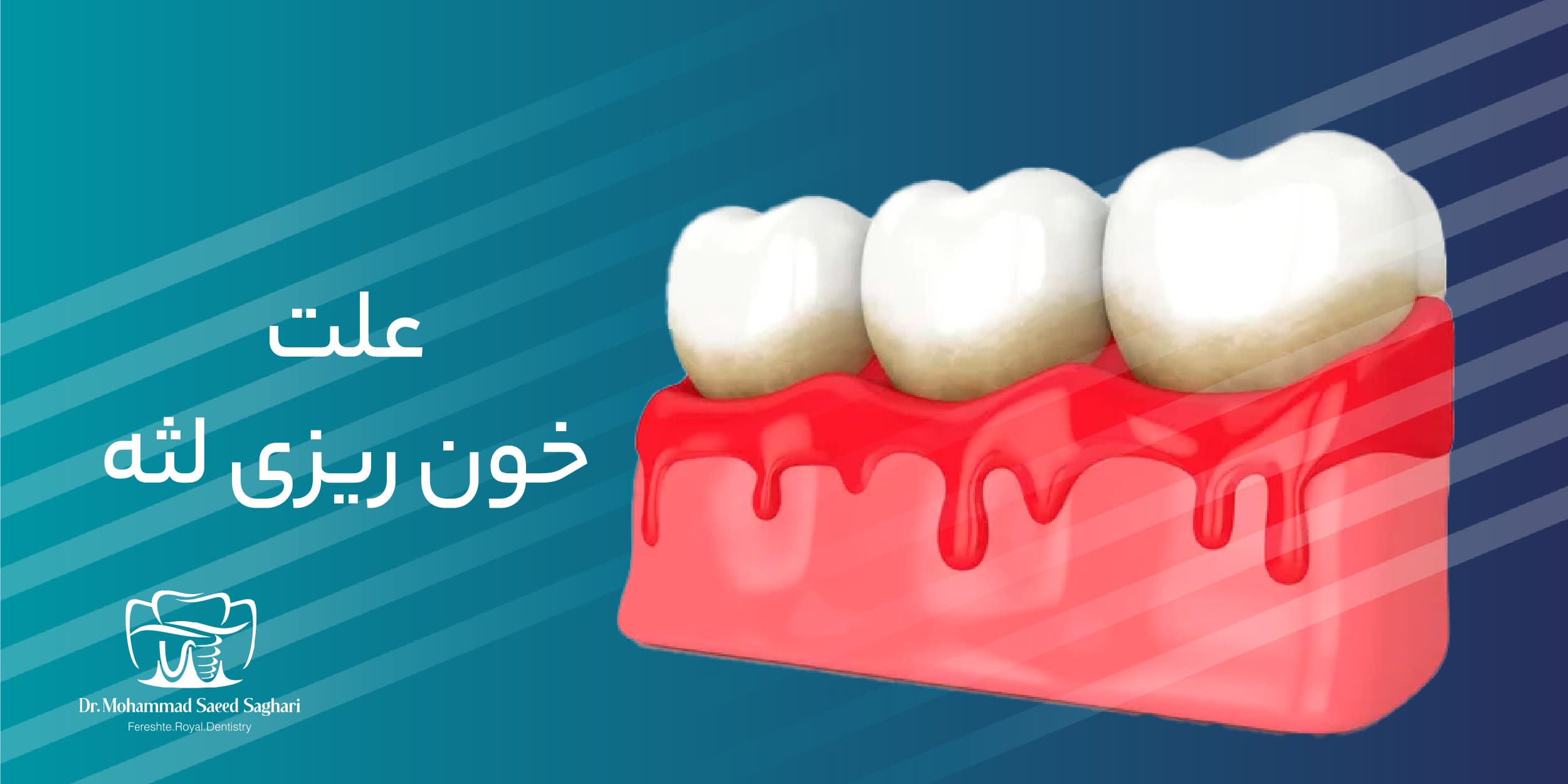 دکترمحمدسعیدساغری ایمپلنتولوژيست دندانپزشک جراح دندانپزشک drsagharidds mohammadsaiedsaghari drsagharid dentist